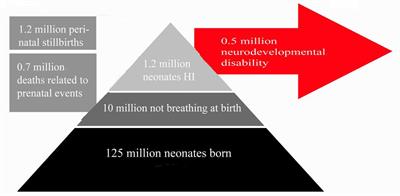 Neonatal Hypoxia Ischaemia: Mechanisms, Models, and Therapeutic Challenges